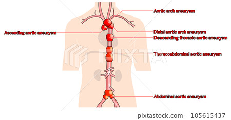 Simple aorta schematic from neck to waist Simple aorta schematic from neck to waist 105615437