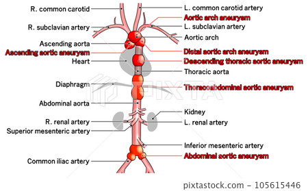 Simple aorta schematic from neck to waist 105615446