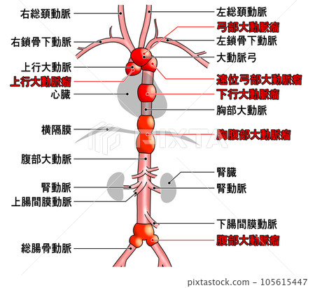 Simple aorta schematic from neck to waist Simple aorta schematic from neck to waist 105615447