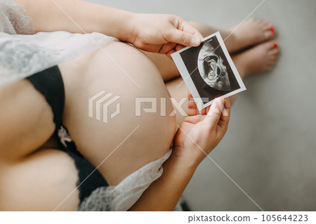 Young pregnant woman with the belly and babys ultrasound paper in hand, pregnancy concept 105644223