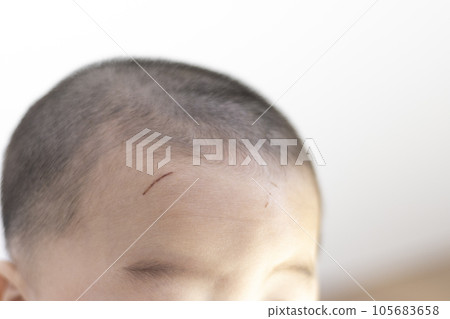 Baby's forehead scratch (boy, Japanese, 0 years old) Baby's forehead scratch (boy, Japanese, 0 years old) 105683658