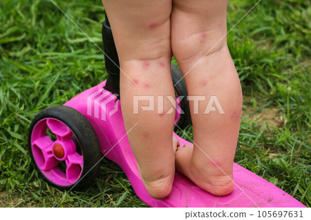 The baby's Legs are on a pink Scooter on a green Grass. The baby's Legs are on a pink Scooter on a green Grass. 105697631