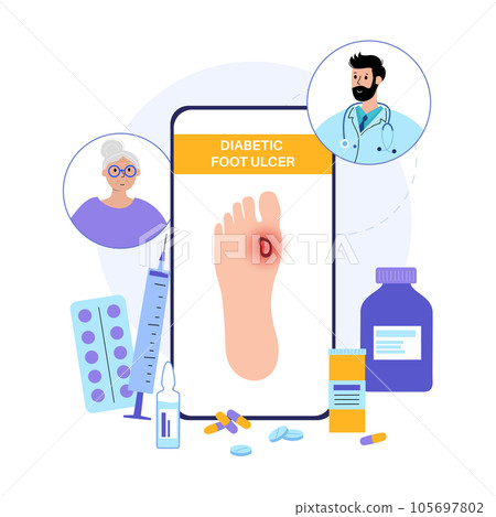 Diabetic Foot Ulcers Diabetic Foot Ulcers 105697802