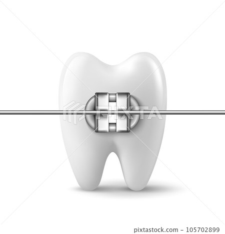 Vector 3d Realistic Tooth with Braces Icon Closeup Isolated on White Background. Medical Dentist Design Template, Clipart. Dental Health Concept 105702899