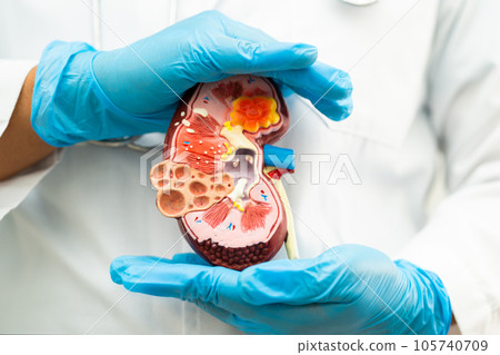 Kidney disease, Chronic kidney disease ckd, Doctor hold model to study and treat in hospital. Kidney disease, Chronic kidney disease ckd, Doctor hold model to study and treat in hospital. 105740709