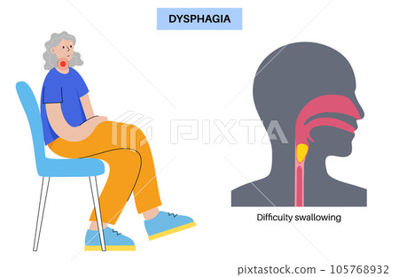 Esophageal achalasia disease 105768932