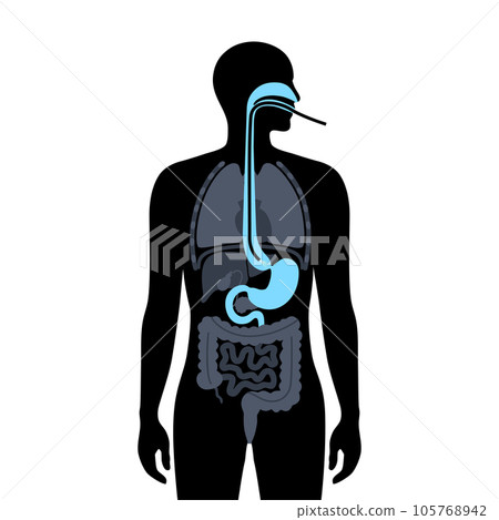 Esophageal achalasia disease 105768942