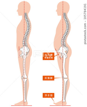 Curvature waist posture comparison 105784191