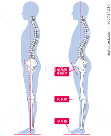Curvature waist posture comparison 105784230