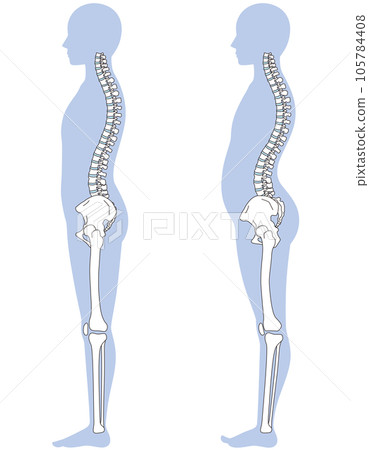 腰部曲度姿勢對比 105784408