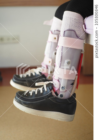 Child cerebral palsy disability, legs orthosis. Child cerebral palsy disability, legs orthosis. 105800846
