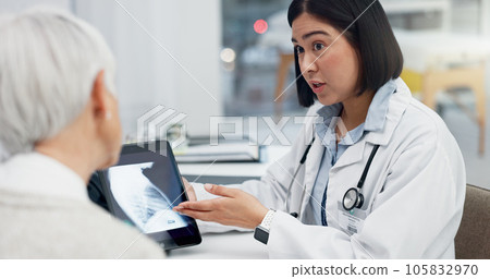 Tablet, xray and patient in consultation with doctor, medical results and analysis, advice on health diagnosis. Chest, anatomy and radiology, communication and women in office, surgery and healthcare 105832970