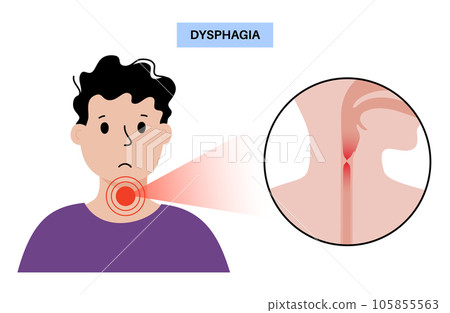 Dysphagia medical poster 105855563