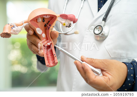 Uterus, doctor holding anatomy model for study diagnosis and treatment in hospital. 105919793