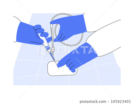 Endovascular surgery abstract concept vector illustration. 105923401