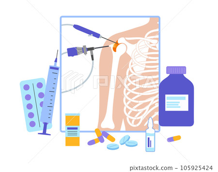 Shoulder arthroscopy poster Shoulder arthroscopy poster 105925424
