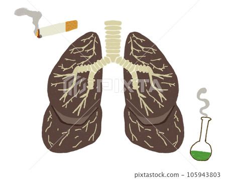 肺部不健康插畫素材 肺部不健康插畫素材 105943803