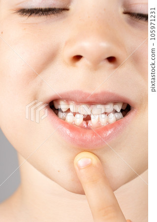 Loss of milk teeth in children. A six-year-old child shows the first baby tooth that has fallen out Loss of milk teeth in children. A six-year-old child shows the first baby tooth that has fallen out 105971231