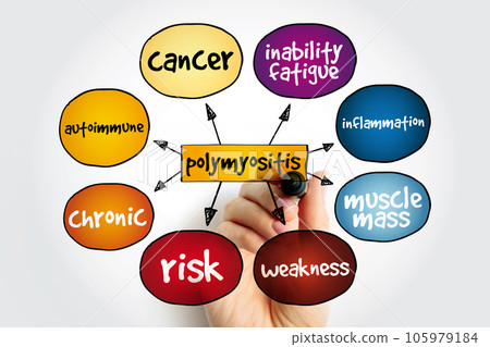 Polymyositis PM mind map, medical concept for presentations and reports 105979184
