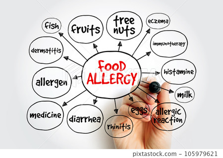 Food allergy mind map, health concept for presentations and reports Food allergy mind map, health concept for presentations and reports 105979621