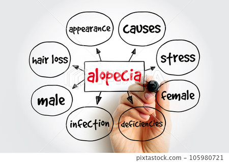 Alopecia mind map, medical concept for presentations and reports Alopecia mind map, medical concept for presentations and reports 105980721