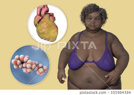 An overweight woman with a close-up view of obese heart and cholesterol molecule, 3D illustration An overweight woman with a close-up view of obese heart and cholesterol molecule, 3D illustration 105984384