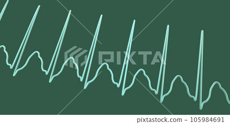 Electrocardiogram displaying supraventricular tachycardia, 3D illustration 105984691