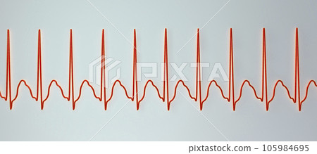 Electrocardiogram displaying supraventricular tachycardia, 3D illustration 105984695