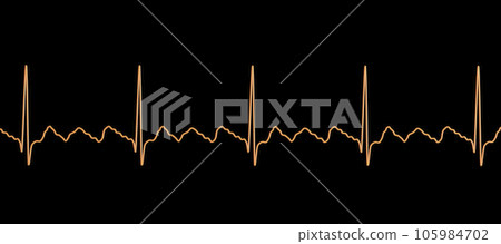 ECG in atrial flutter, 3D illustration ECG in atrial flutter, 3D illustration 105984702