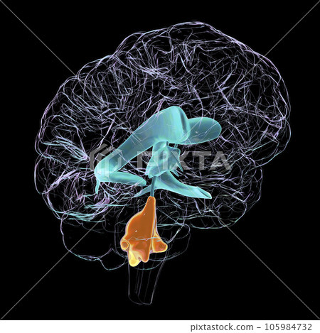 Enlarged fourth ventricle of the brain, 3D illustration Enlarged fourth ventricle of the brain, 3D illustration 105984732