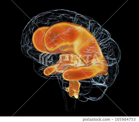Enlarged ventricles of the child brain, 3D illustration 105984753