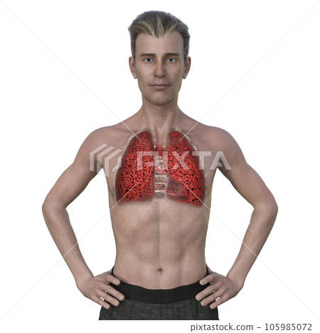 A 3D illustration of a man with transparent skin, revealing the condition of smoker's lungs. 105985072