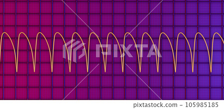Electrocardiogram displaying ventricular tachycardia, 3D illustration 105985185