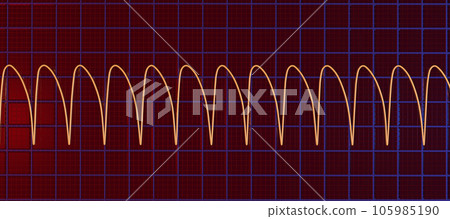 Electrocardiogram displaying ventricular tachycardia, 3D illustration 105985190