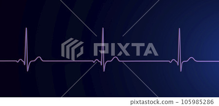 Electrocardiogram ECG displaying sinus bradycardia, 3D illustration Electrocardiogram ECG displaying sinus bradycardia, 3D illustration 105985286