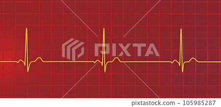 Electrocardiogram ECG displaying sinus bradycardia, 3D illustration 105985287