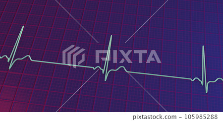 Electrocardiogram ECG displaying sinus bradycardia, 3D illustration 105985288