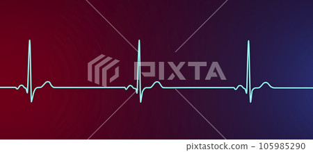 Electrocardiogram ECG displaying sinus bradycardia, 3D illustration Electrocardiogram ECG displaying sinus bradycardia, 3D illustration 105985290