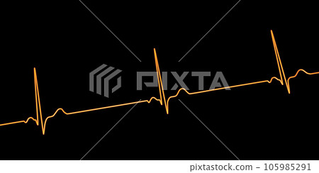 Electrocardiogram ECG displaying sinus bradycardia, 3D illustration 105985291