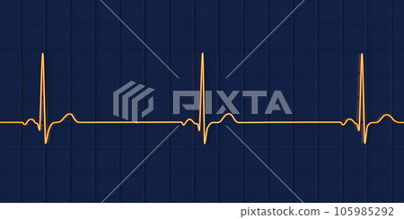 Electrocardiogram ECG displaying sinus bradycardia, 3D illustration 105985292