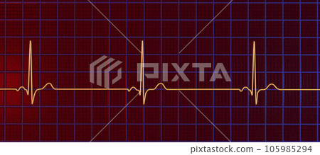 Electrocardiogram ECG displaying sinus bradycardia, 3D illustration 105985294
