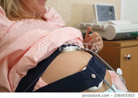 A fetal cardiac monitoring device for pregnant women. Pregnancy cardiac monitoring. STV test. Fetal cardiac monitor in pregnant women. Fetal cardiography. A fetal cardiac monitoring device for pregnant women. Pregnancy cardiac monitoring. STV test. Fetal cardiac monitor in pregnant women. Fetal cardiography. 106005983