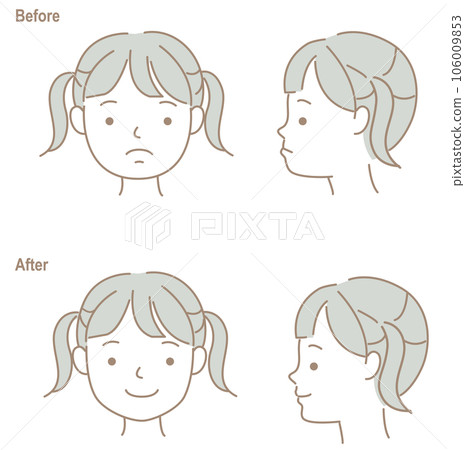 Children's faces with opposite occlusion, before and after orthodontic treatment Children's faces with opposite occlusion, before and after orthodontic treatment 106009853