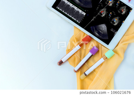 Patient cardiac activity is being monitored on an electrocardiogram ECG chart by doctor using digital tablet to prescribe the correct treatment 106021676