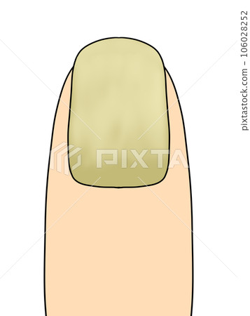 fingernails (yellow) fingernails (yellow) 106028252