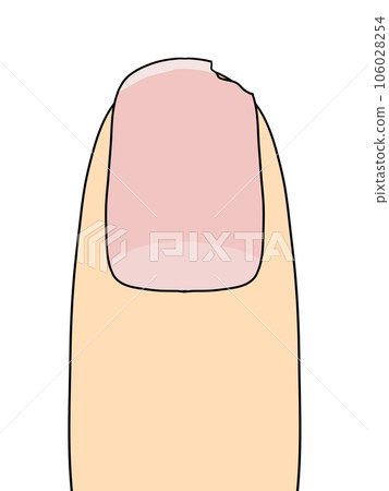 fingernails (missing) 106028254