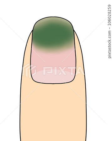 fingernails (green) 106028259