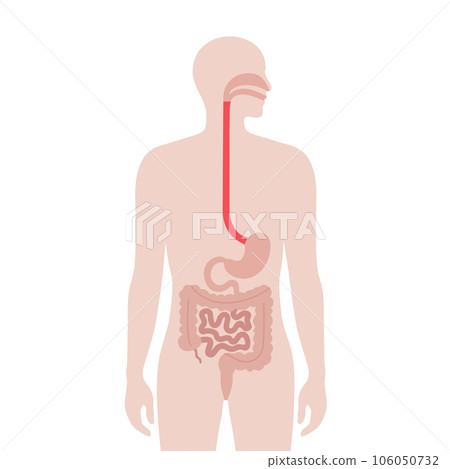 Dysphagia medical poster Dysphagia medical poster 106050732