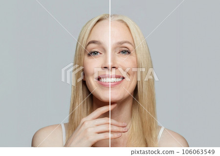 Blonde model woman with young clean skin and wrinkles. Aging and youth, aesthetic surgery 106063549