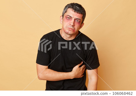 Injured man in black T-shirt victim of violence with bruises and abrasions on his face isolated over beige background touching his stomach  feeling pain grimacing looking at camera. 106068462